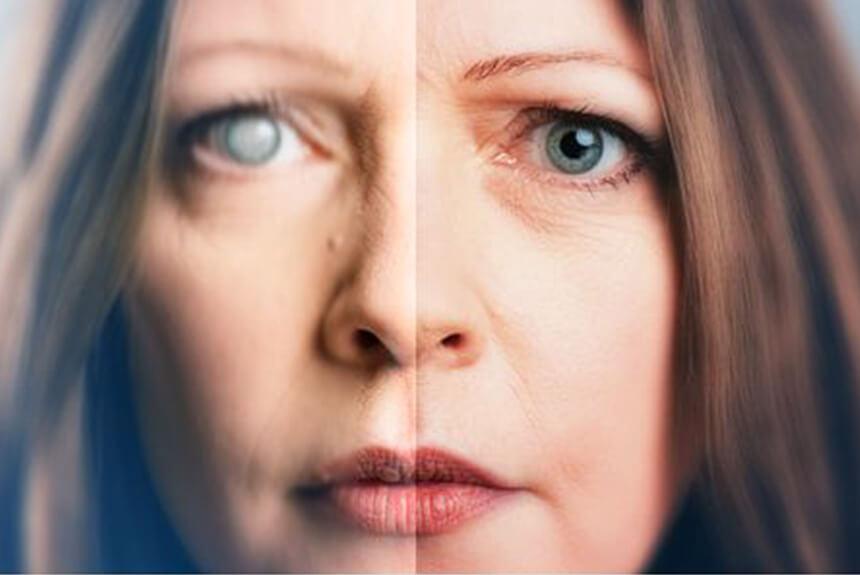 إزالة المياه البيضاء